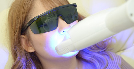 Bコース セルフホワイトニング