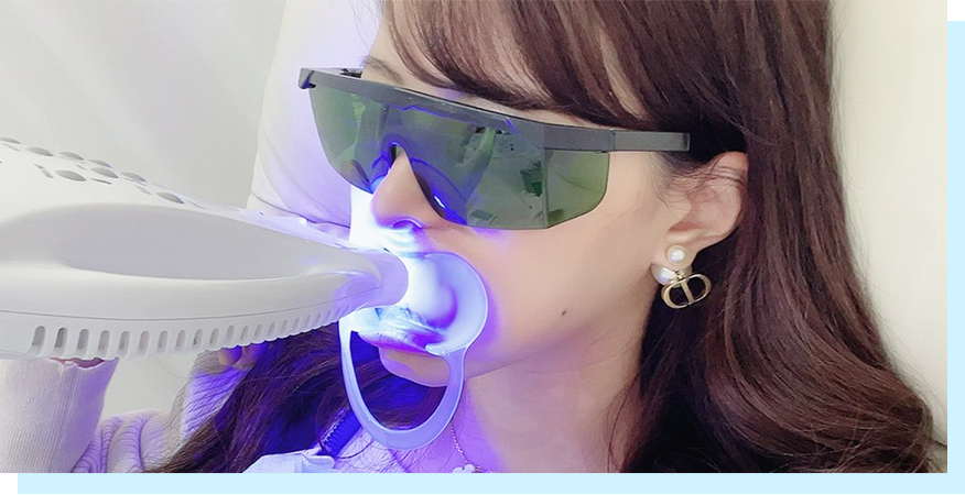 ホワイトニング Bコース